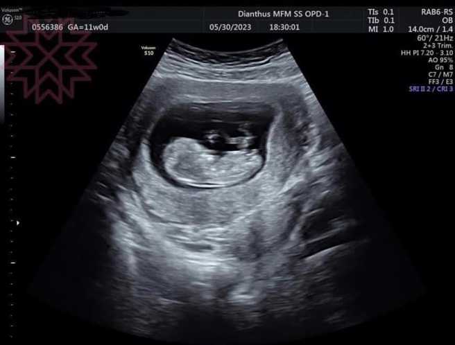 杨绣惠PO超音波照求恭喜。（图／FB@杨绣惠）