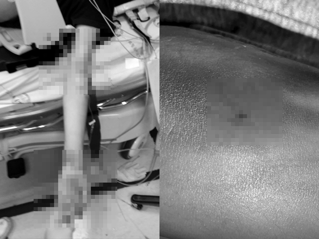 赖男家属近日曝光赖男第一时间的送医照片，强调赖男当时仅左手臂有插针，且并未插管抢救，希望真相能尽快厘清。（民眾提供）