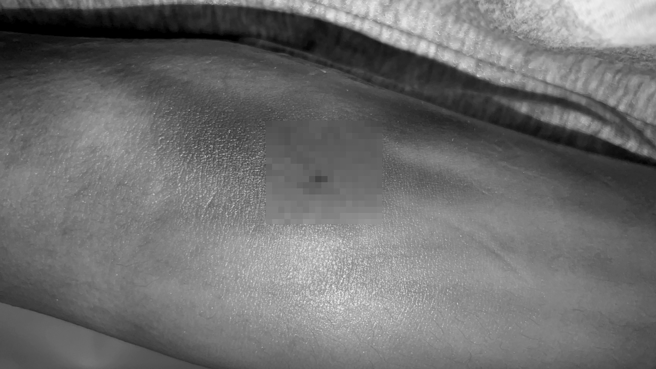 赖男家属近日曝光赖男第一时间的送医照片，强调赖男当时仅左手臂有插针，且并未插管抢救，希望真相能尽快厘清。（民眾提供）