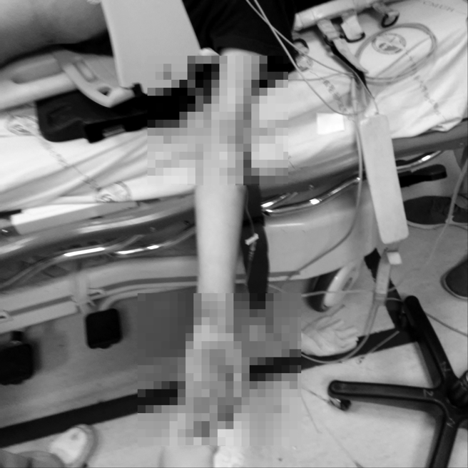 赖男家属也曝光赖男第一时间的送医照片，强调赖男当时仅左手臂有插针，且并未插管抢救，希望真相能尽快厘清。（民眾提供）