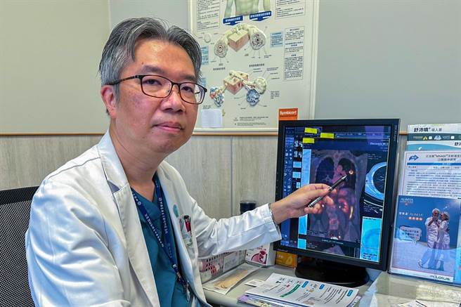 中医大新竹附医胸腔内科主任庄子仪诊断林翁罹患早期肺癌，确认癌细胞没转移才能手术。（罗浚滨摄）