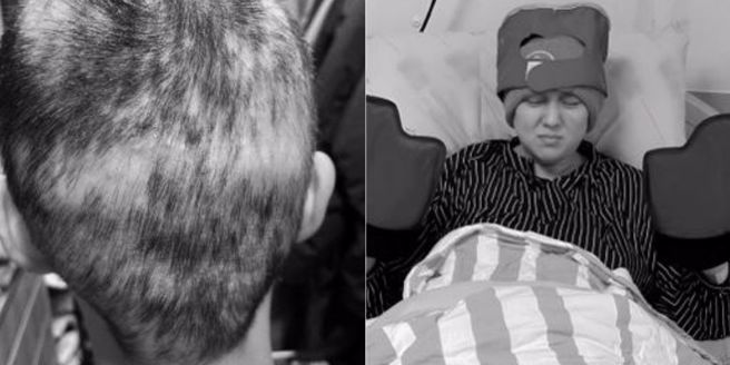 朱芯仪鼓起勇气在新书里曝光化疗后的光头照和病容。（重版文化提供）