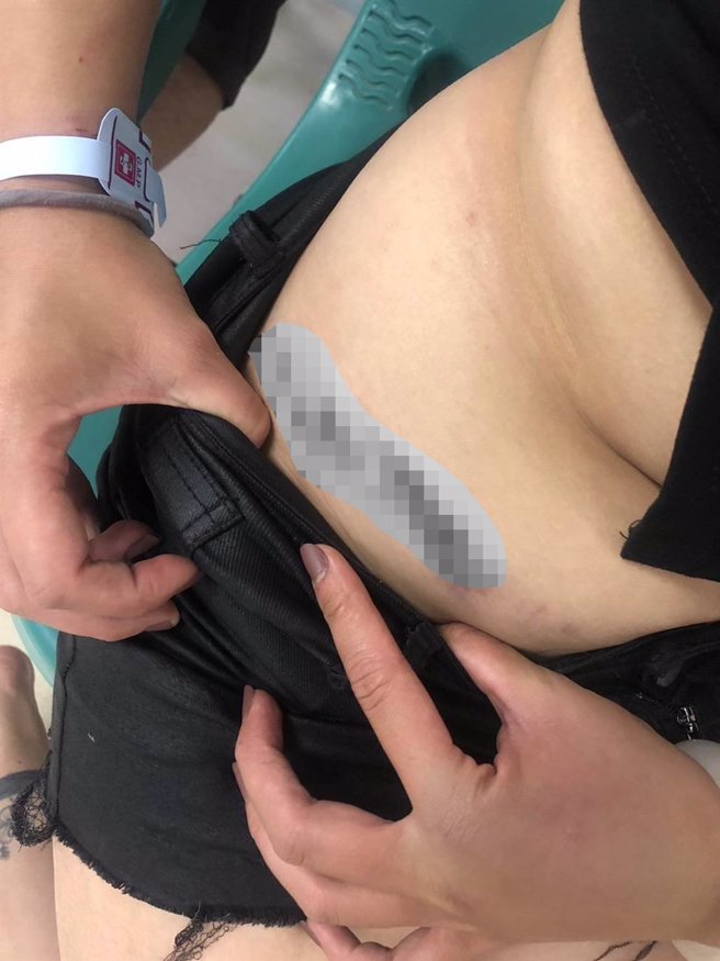 台东情侣檔无端遭多人攻击，警方锁定相关嫌疑人身份进行追缉。（民眾提供／萧嘉蕙台东传真）