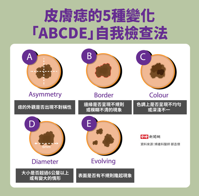 皮肤痣的5种变化，「ABCDE」自我检查法(制图/陈友龄)