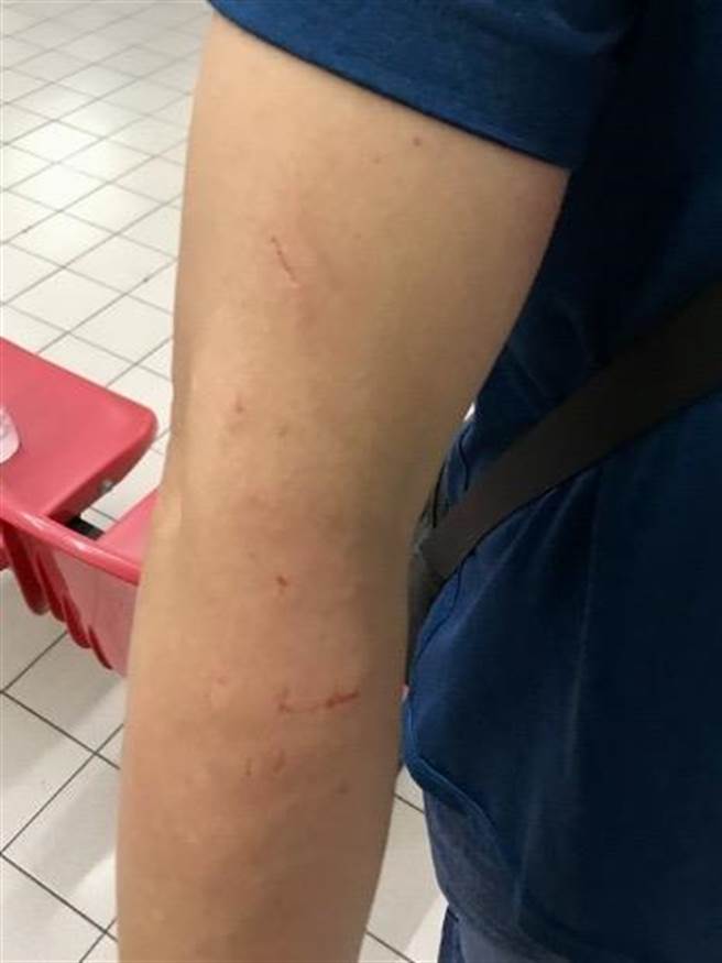 過程中還有2名幹員遭頑強抵抗的嫌犯抓傷。（讀者提供／張毓翎台南傳真）