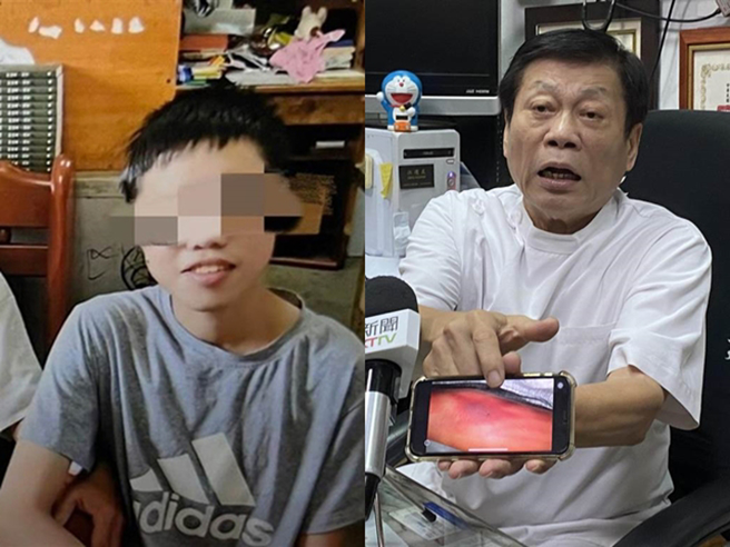 高大成強調賴男脊柱、顱骨完好且口鼻有瘀傷、死後體溫上升、急診醫護稱無在手臂打針，遺體也無腦水腫、肺水腫，種種跡象證明賴男是死後才墜樓。（翻攝照片）