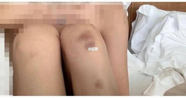 大陸一名26歲女子指控，她在馬爾地夫遭管家性侵。（圖／翻攝自小紅書）