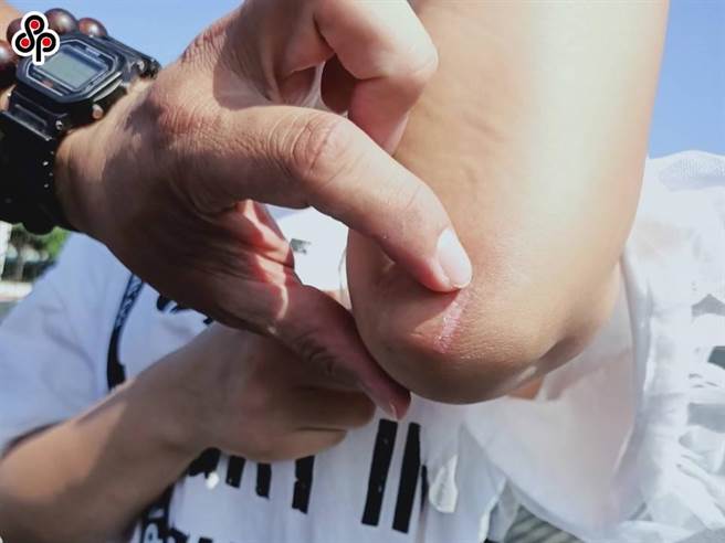 现代人压力大、生活忙碌，关节炎的年龄层逐渐下降，甚至有许多未满30岁的年轻族群，也开始受到关节问题影响。图为关节示意图。（本报资料照片）