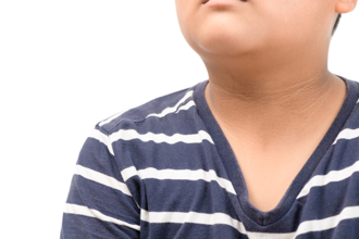 9歲男童過胖「脖子黑一片」 醫照超音波傻了：中度脂肪肝