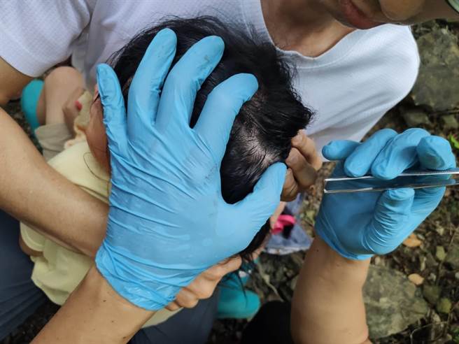 宜蘭縣礁溪鄉月眉坑步道，今（2日）一行9人，含7名大人、2名小孩，在健行時遭受蜂群攻擊。（宜蘭縣消防局提供／吳佩蓉宜蘭傳真）
