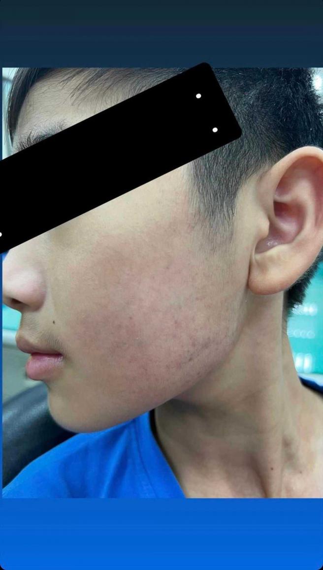 小兒科醫師管教兒子採取激烈的手段，在孩子臉頰上留下明顯掌摑痕跡。（圖／翻攝自網路）