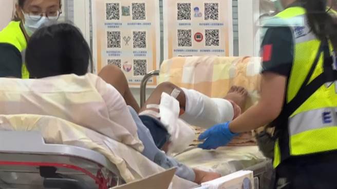 台东1名年仅13岁的黄姓女国中生无照骑机车双载，不明原因失控衝撞路边护栏，造成右腿变形无法站立。（民眾提供／萧嘉蕙台东传真）