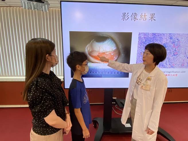 台中荣总儿童过敏免疫科医师蔡明瑾指出，龙小弟右下结膜有两个5mm大的结节，经眼科手术切除，病理切片发现是自体免疫疾病。（冯惠宜摄）