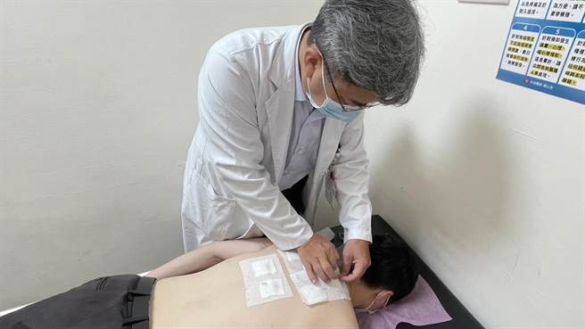 光田综合医院中医部医师王敦正指出，三伏贴是白芥子、细辛、乾姜等药材制成的药饼，将其敷贴于上背部的穴位对于过敏性鼻炎、皮肤炎等有不错疗效。示意图非当事病患。（光田综合医院提供／潘虹恩台中传真）