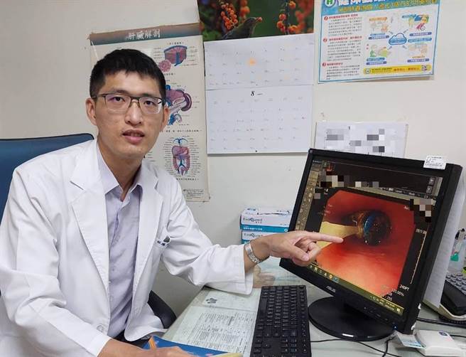 林德福医师提醒，误食异物可能造成食道破裂的风险，一定要小心留意。（大千医院提供／李京升苗栗传真）