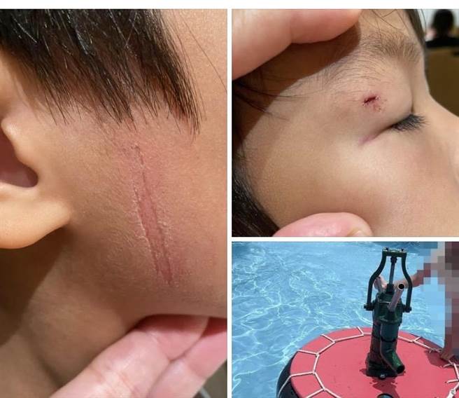 昨日有网友在脸书指出，宜兰国际童玩节星空水战场的戏水设施翻倒，导致该名网友7岁孩子的眼角和脸颊遭撞击而刮伤。（民眾提供／吴佩蓉宜兰传真）