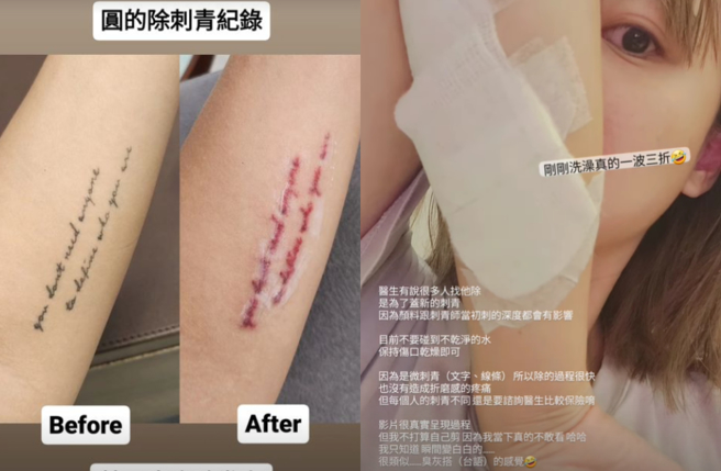 一隻阿圓表示刺完青的手臂有灼熱感。(圖/一隻阿圓 IG)