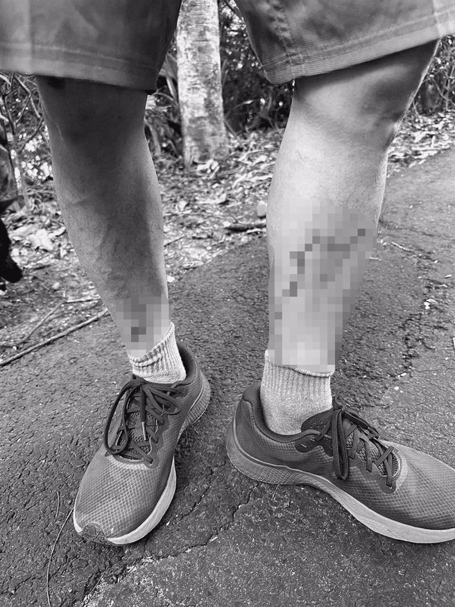 新竹市议员黄文政接获民眾陈情，指在爬十八尖山时，突然遭到浪猫飞扑袭击以致双脚受伤，大量出血，缝了好几针。（摘自黄文政脸书／陈育贤新竹传真）