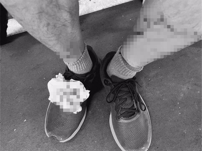 新竹市议员黄文政接获民眾陈情，指在爬十八尖山时，突然遭到浪猫飞扑袭击以致双脚受伤，大量出血，缝了好几针。（摘自黄文政脸书／陈育贤新竹传真）