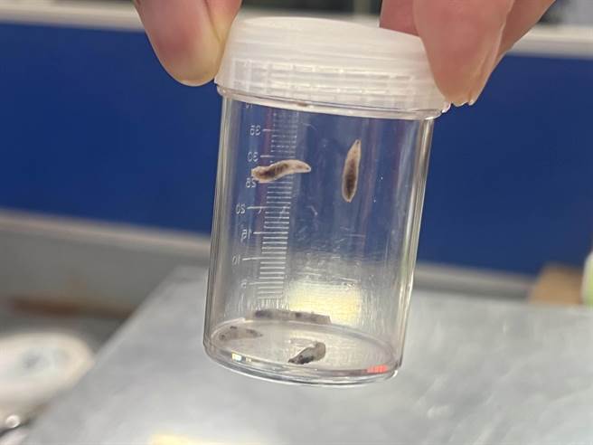 大甲李综合医院耳鼻喉科医师林金生从患者耳内抓出蛆。（陈淑娥摄）