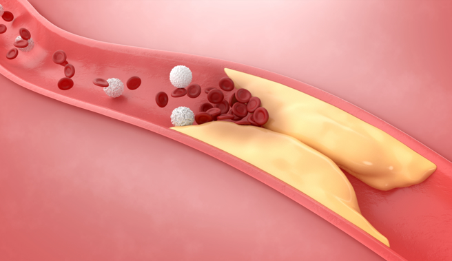 膽固醇是一種脂肪類的蠟性物質，也是構成人體細胞膜、荷爾蒙、維生素D的重要原料。(示意圖/Shutterstock )