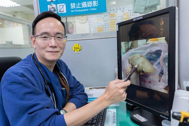 光田医院急诊部顏嘉德医师提醒民眾，不明野菇不要採摘食用，以免毒从口入。（光田医院提供)