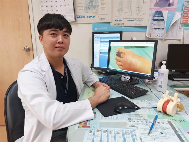 医师谢逸樵表示，感染海洋弧菌非常危险，若处理不当，也容易造成器官衰竭，死亡率甚至高达5成以上。(陈淑娥摄)