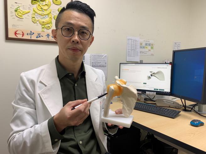 骨科医师廖志祥表示，反式人工肩关节是藉由与传统人工肩关节相反的特殊设计，把关节盂变成球头，肱骨变成凹窝，置换后可避开受损的旋转肌腱，而改由三角肌来恢復肩关节功能，让患者举高手臂。(图片来源：中正骨科)