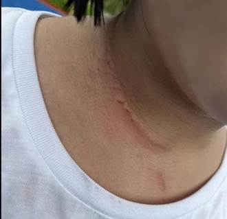 南投福興溫泉公園試營運 女童卻遭「鋼索割喉」 