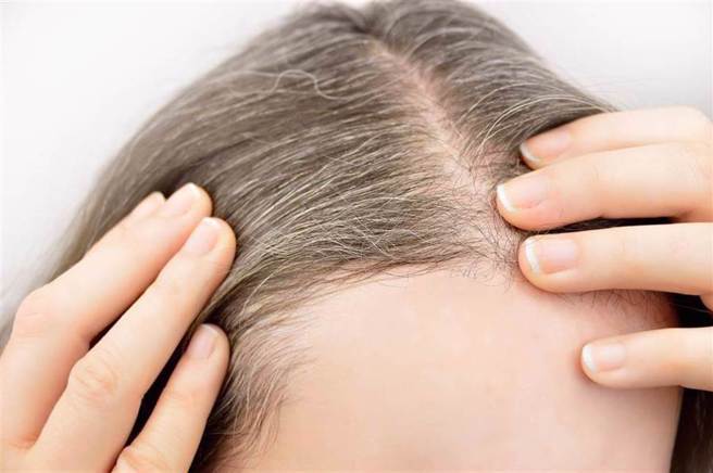 许多人都有白头髮的困扰，有什么方法可以延缓它生长？（示意图／Shutterstock）