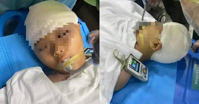 大陆长沙一名家长控诉，自己的9岁女儿在学校遭到宋姓男老师拿三角把殴打头部，导致头骨碎裂、脑浆溢出，进行开脑手术后目前仍处危险期。（图／抖音）