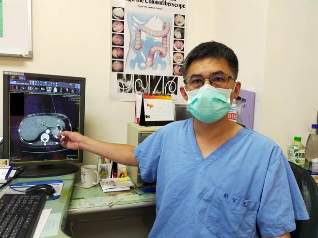 部苗直肠外科主任郑智元提醒直肠癌及肝臟癌转移问题。（部苗提供／谢明俊苗栗传真）