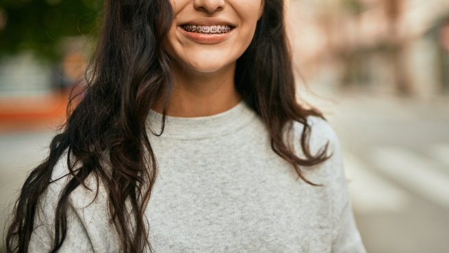 女子發現姑姑的孩子幾乎都有花錢做牙齒矯正，好奇沒戴過牙套的人是不是少數。（圖／示意圖，達志影像）