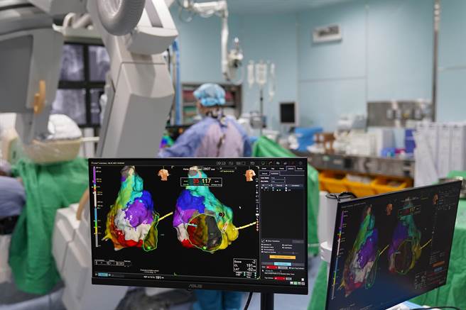 中国医药大学新竹附设医院心臟内科使用电烧心臟迷走神经节，治疗迷走神经晕厥。（中国医药大学新竹附设医院提供／罗浚滨新竹传真）