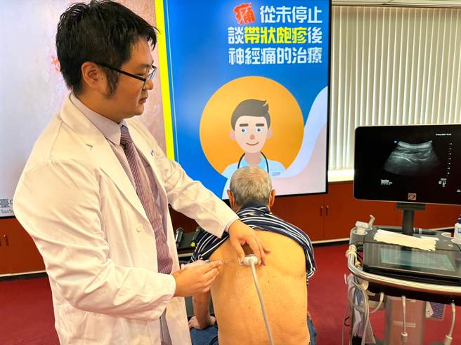 台中荣总麻醉部疼痛科指出，严重的带状疱疹后神经痛，透过神经阻断术、神经烧灼术等介入治疗，神经痛感觉明显下降。（冯惠宜摄）