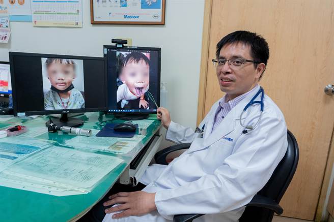 光田医院儿科医师江国梁解说「黑毛舌」症状，是临时且无害的口腔状况，透过治疗可完全治癒。（陈淑娥摄）