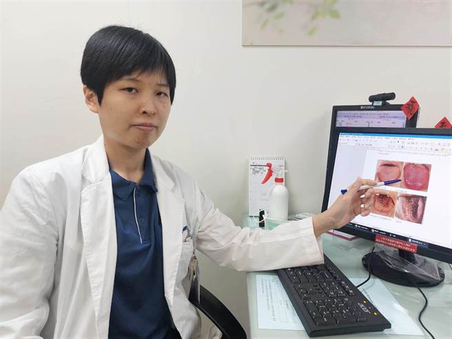 光田中医部医师畲佳颖从小儿肠胃调理观点解说「黑毛舌」症状。（陈淑娥摄）