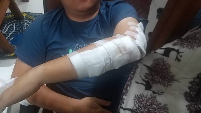 赖员全身多处擦挫伤，所幸送医后意识清楚并持续接受治疗中。（图／警方提供）