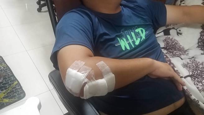 赖员全身多处擦挫伤，所幸送医后意识清楚并持续接受治疗中。（图／警方提供）