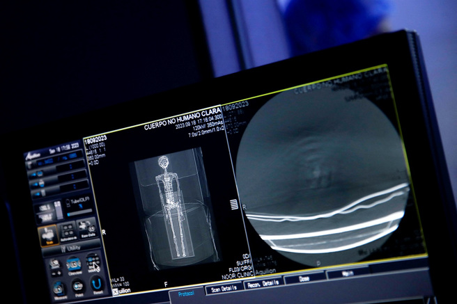 2具「千年外星人」遗骸19日送交机构进行电脑断层扫描。（图／路透社）