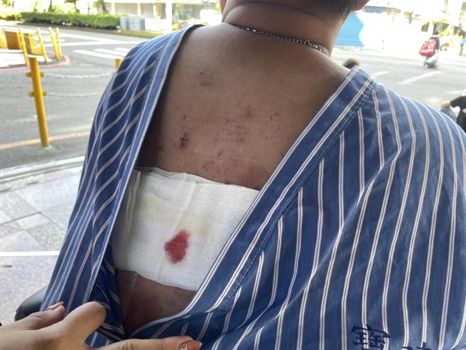 明扬戴姓员工逃出时背后遭割伤，目前仍未出院。（洪靖宜摄）