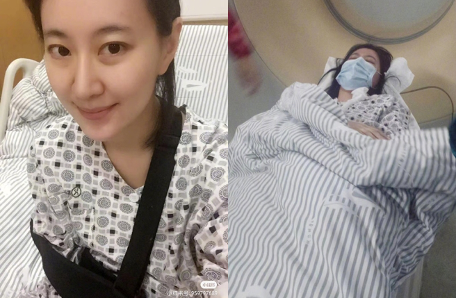 王乐君晒出受伤照。（图／翻摄自是段小姐来了微博）