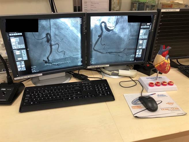 台北荣总桃园分院提醒，若发生胸闷不舒服应提高警觉，儘早就医检查，避免错失治疗黄金时机。(院方提供／蔡依珍桃园传真)