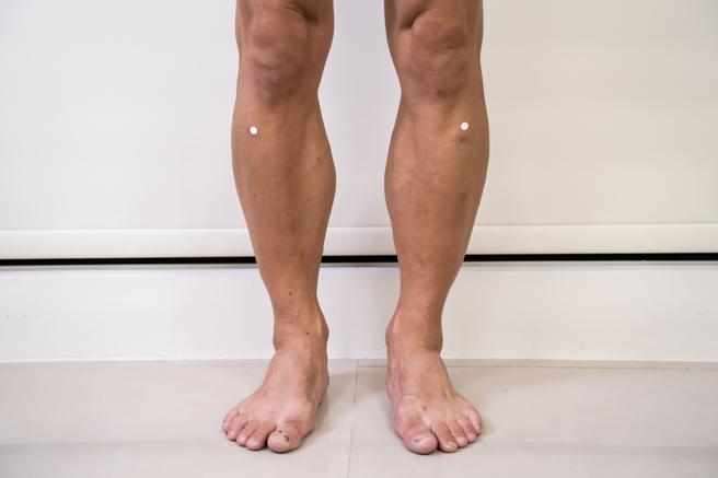 按摩足三里穴更是平常保健与消胀气的万用穴。（图片来源：马光中医诊所提供）