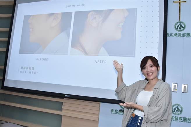 女设计师6日回到彰化基督教医院分享接受正颚手术的经验，并露出灿烂笑容表示很满意手术成果。（彰化基督教医院提供／孙英哲彰化传真）
