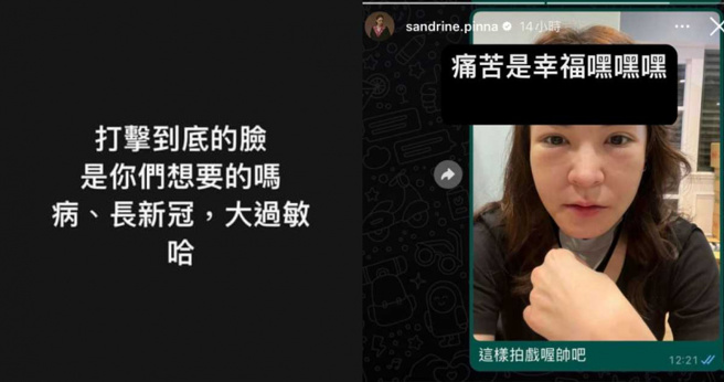 张榕容因为日前确诊新冠接着又大过敏，因此脸肿得像猪头。（图／翻摄张榕容IG）