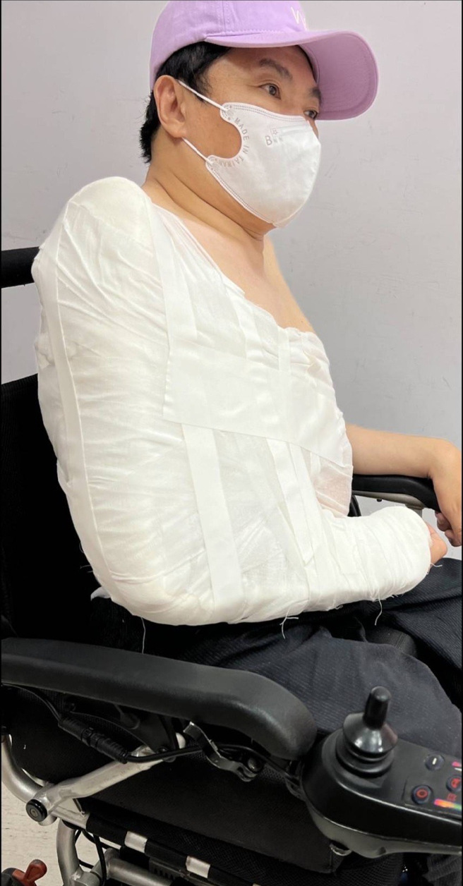 蔡义德努力做復健。（蔡义德提供）