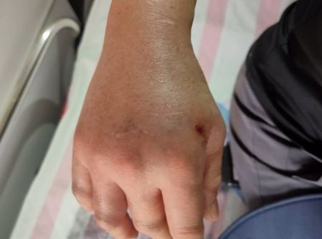 又爆虎头蜂袭击！苗栗「神仙纵走」8名登山客遭螫伤，其中5人送医，目前消防局已经封闭步道。(戴志扬翻摄)