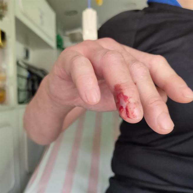 手指遭螫到流血。（民眾提供／李京升苗栗传真）