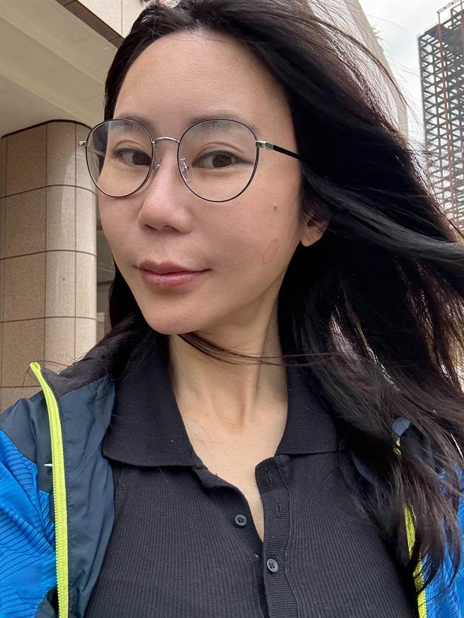 安晨妤臉上疑似出現吻痕。(開店一二三提供)